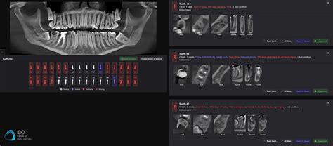 CBCT and Dental Radiology Report Services .